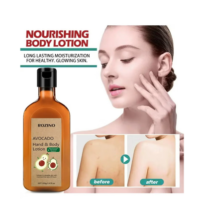 Avocado body lotion for dry skin in autumn and winter, moisturizing, anti-itching and hydrating avocado body lotion